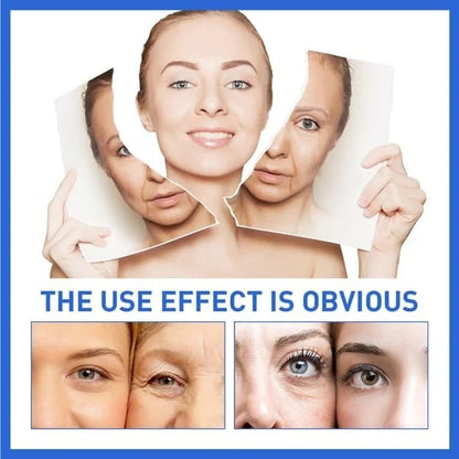 💯Last Day Promotion 70% OFF💯-Tiworld™ Botox Facial Essence