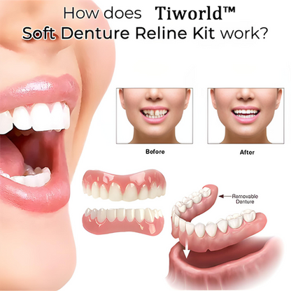Tiworld™  Soft Denture Reline Kit