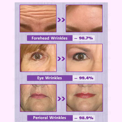SEAGRIL-PEPTIDE  Wrinkle Reducing Cream contains 12 different peptides (eliminates wrinkles in 1 minute)